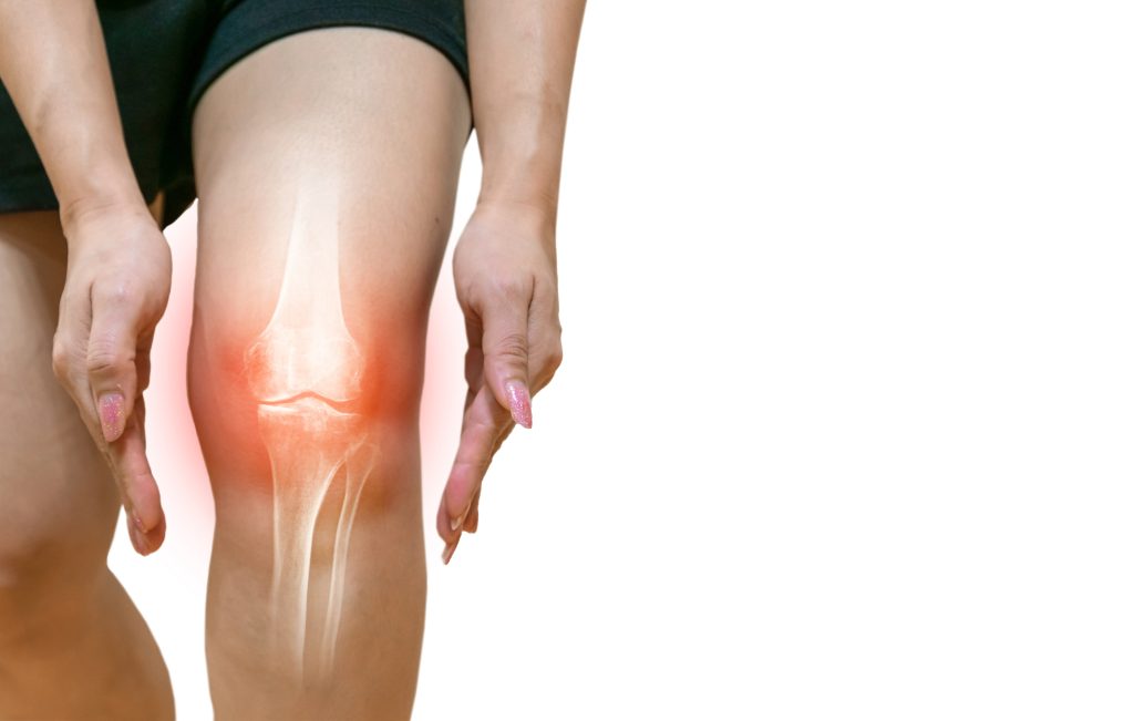 Knee Pain & Stiffness